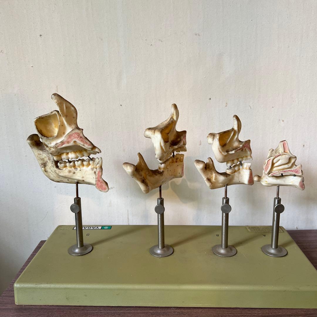 歯のモデル　発育模型